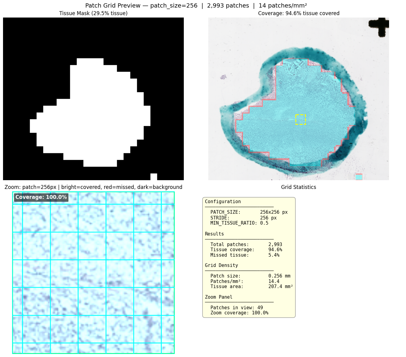 High-resolution extraction grid preview