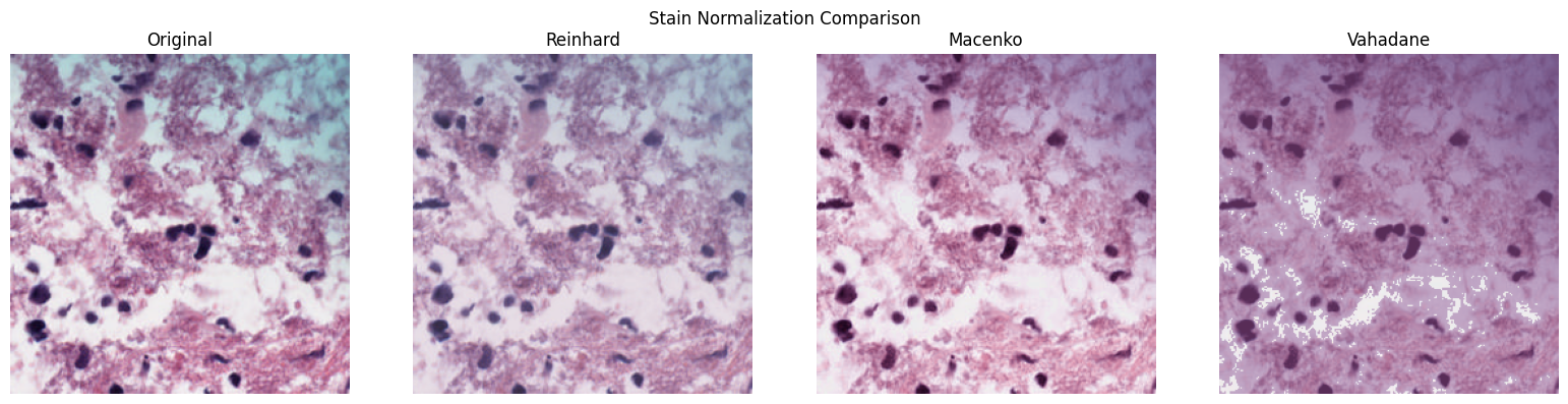 Reinhard, Macenko, and Vahadane normalization comparison