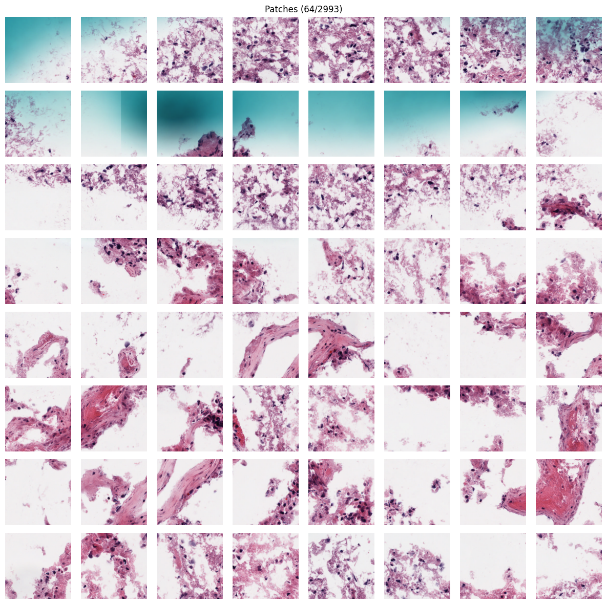 Gallery of extracted patches