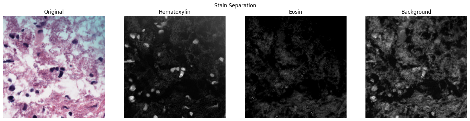 H&E stain separation into hematoxylin, eosin, and background channels