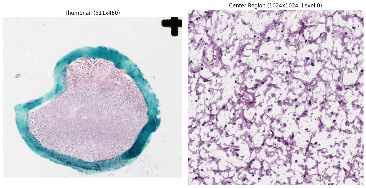 Slide thumbnail and center region side-by-side
