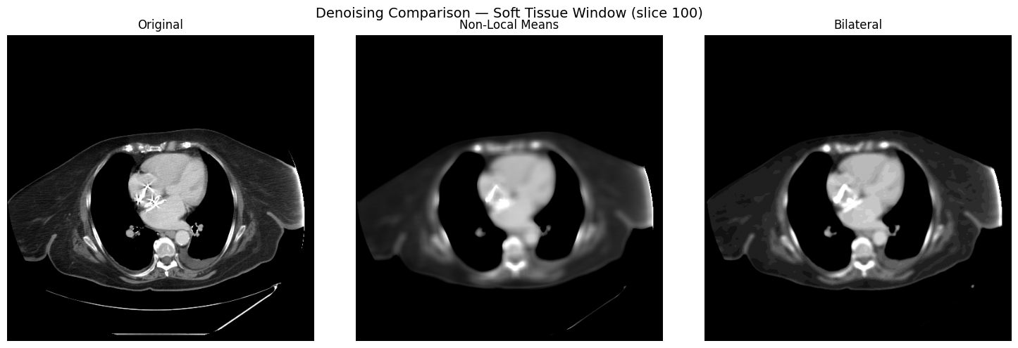 Original vs non-local means vs bilateral denoising