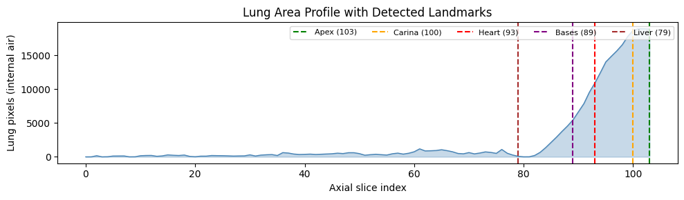 Lung area profile with detected anatomical landmarks