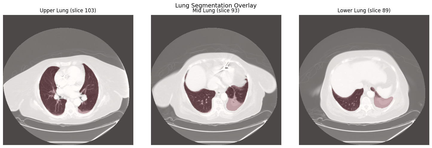 Lung segmentation overlay on upper, mid, and lower lung zones