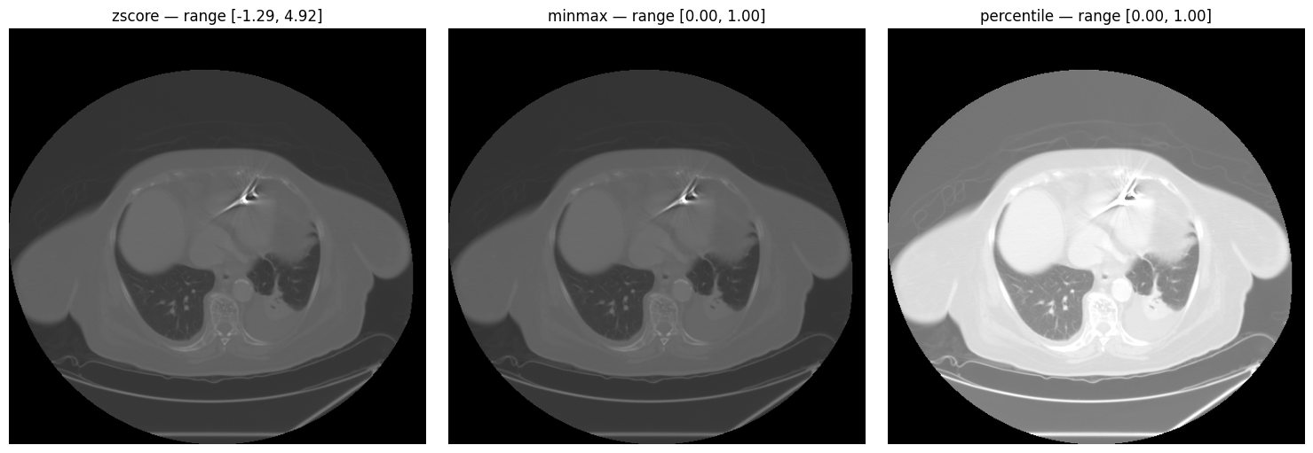 Z-score, min-max, and percentile normalization comparison