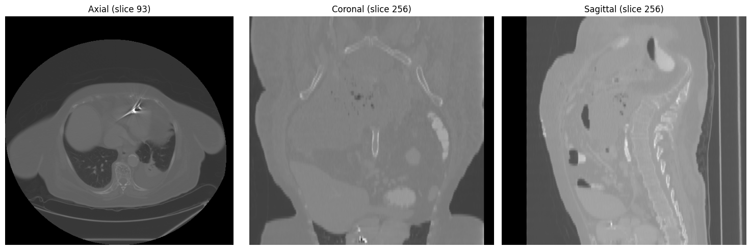 Axial, coronal, and sagittal views at mid-chest