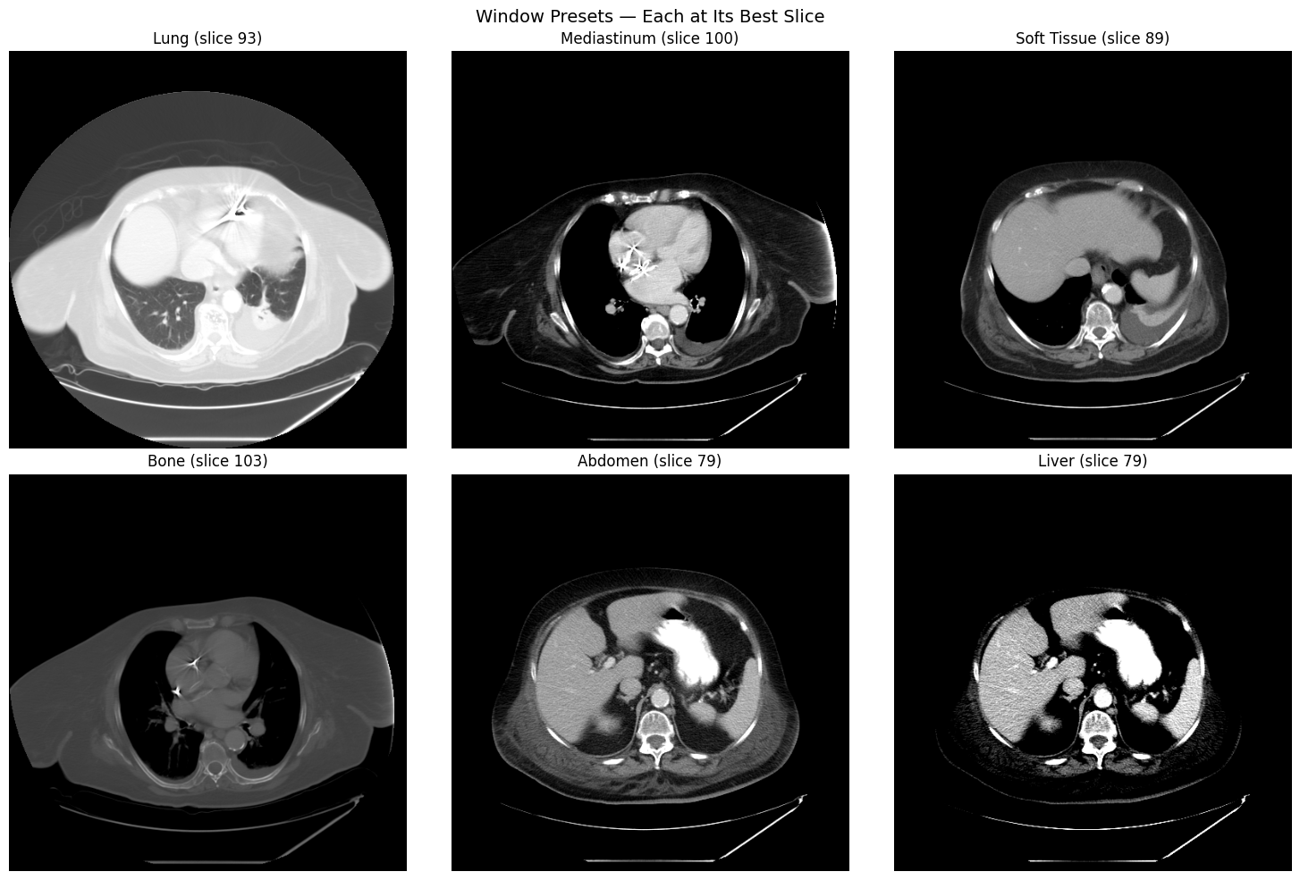 Six window presets showing different anatomical structures