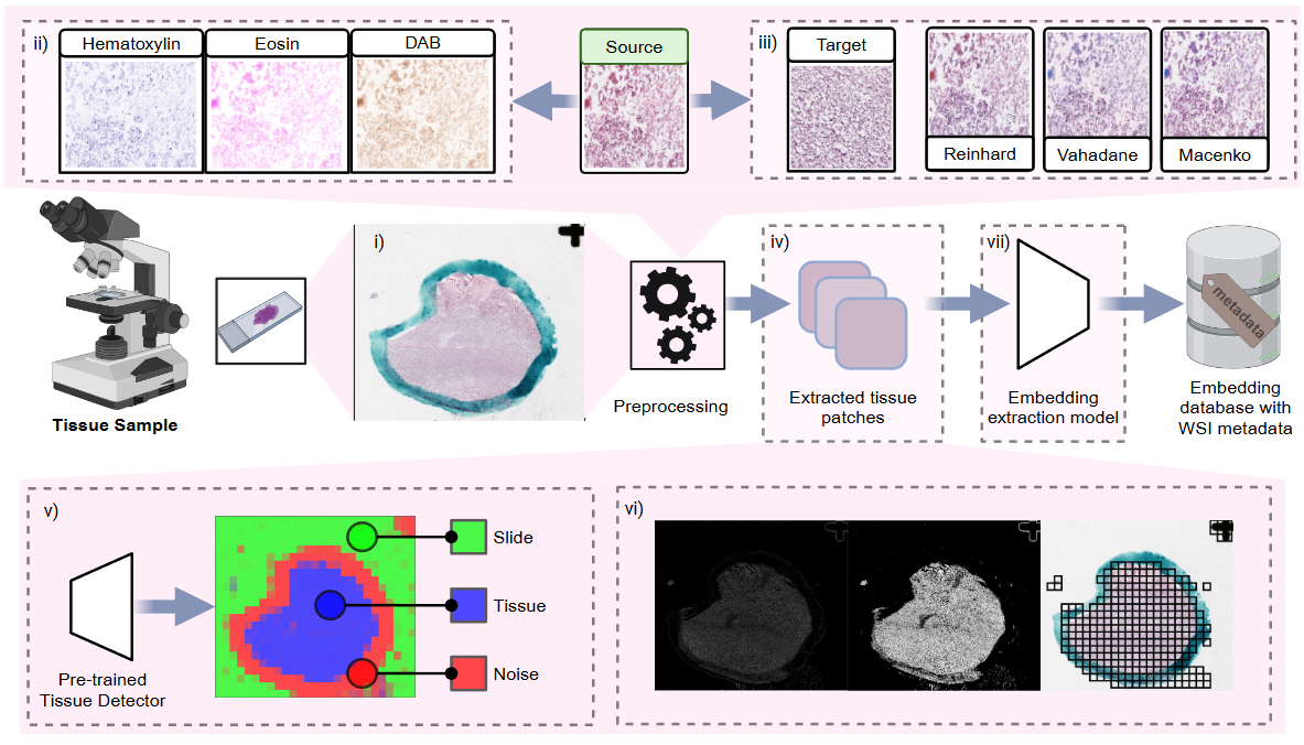 Whole Slide Image Processing Pipeline